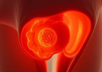 4 cm zyste am eierstock gefährlich