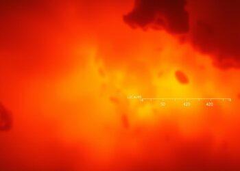 blutzucker zu hoch ab wann gefährlich