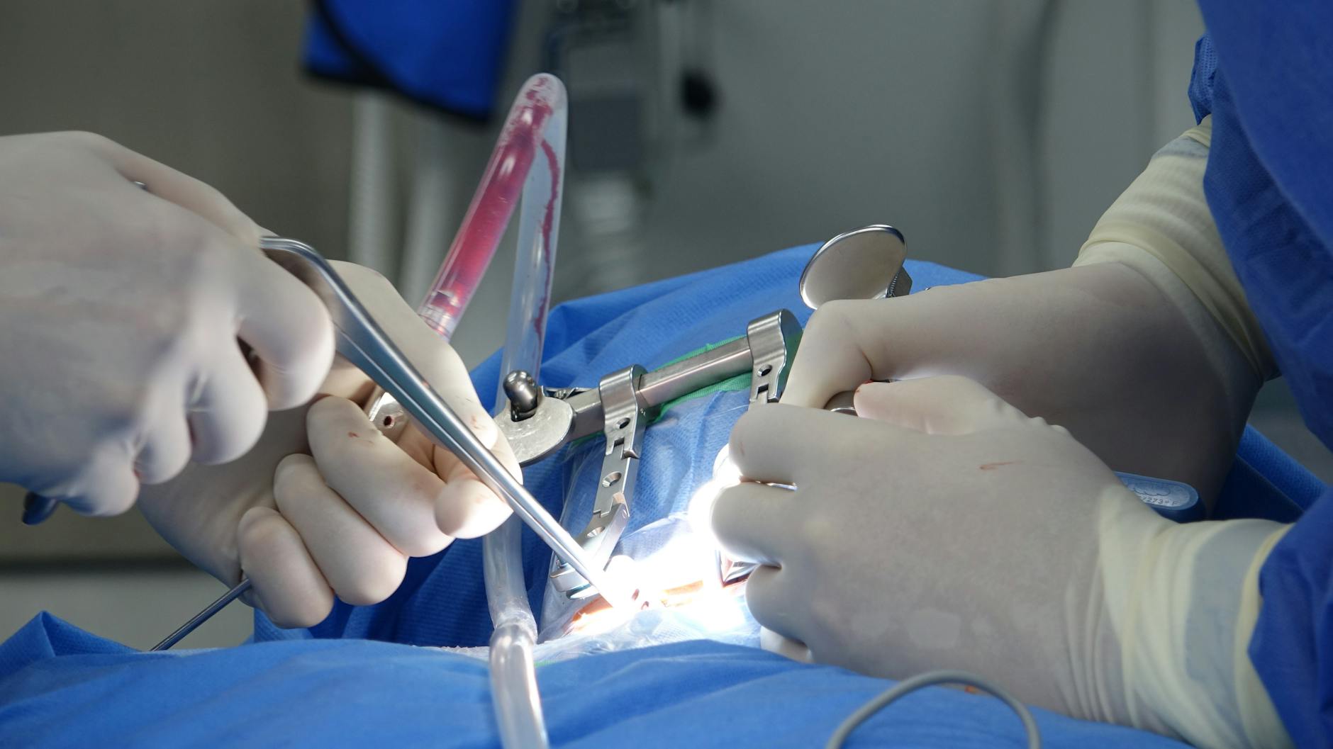 Symbolbild zum Thema Kehlkopfentfernung Doskozil